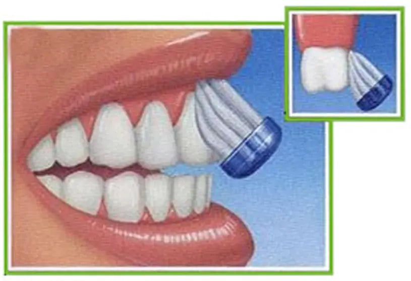 Brushing at a 45 degree angle against the gum line