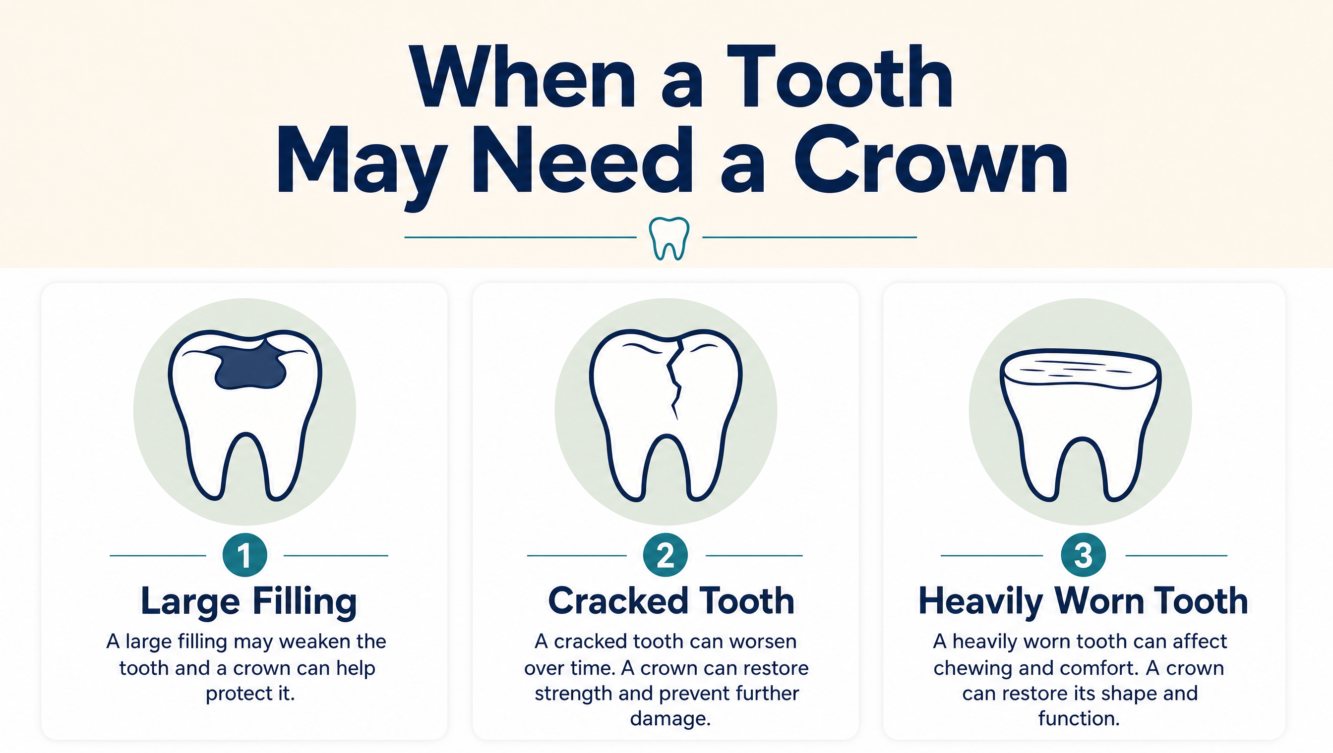 When a tooth may need a crown: large filling, cracked tooth, or heavily worn tooth
